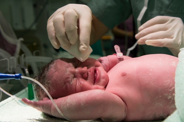 What Happens In A C Section Delivery?