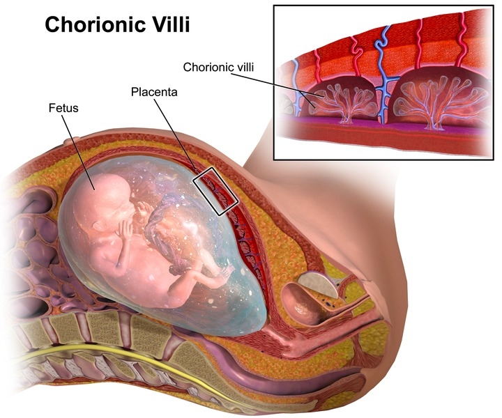 All About Chorionic Villus Sampling (CVS) Testing During Pregnancy