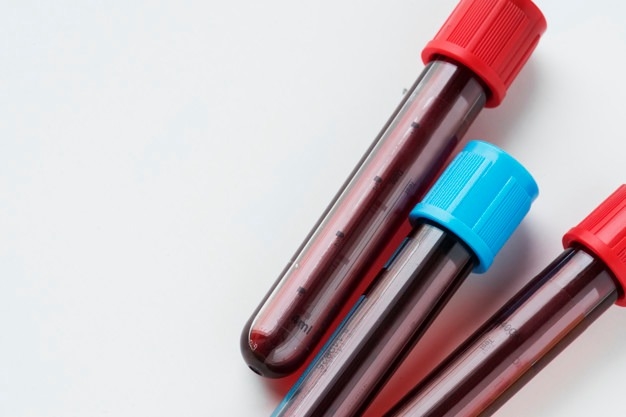 All Blood Tests and Investigations During Pregnancy