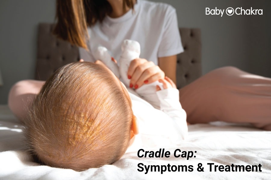 Cradle Cap: Symptoms And Treatment
