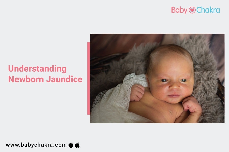 Understanding Newborn Jaundice