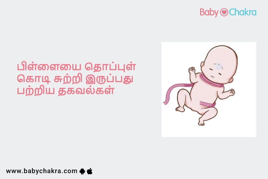 பிள்ளையை தொப்புள் கொடி சுற்றி இருப்பது பற்றிய தகவல்கள்