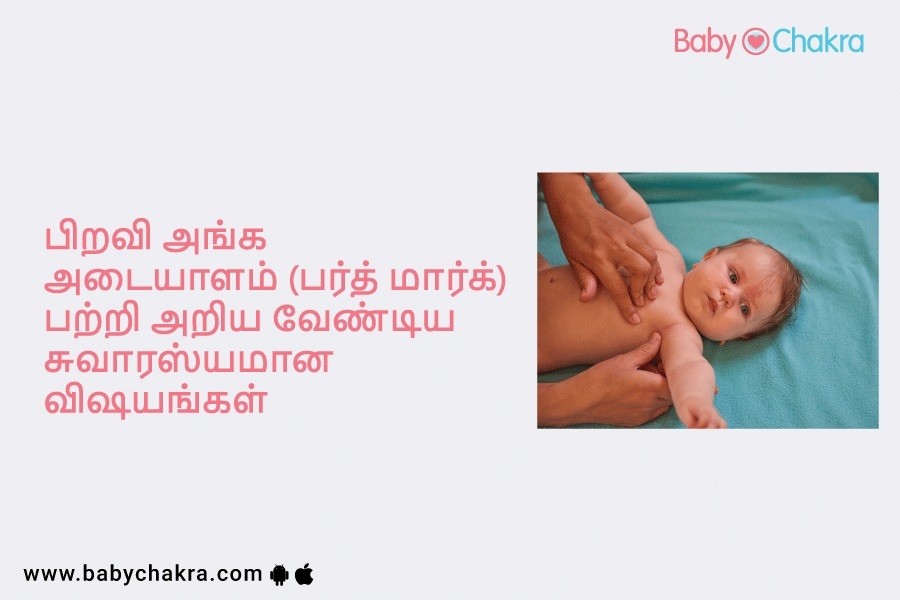 பிறவி அங்க அடையாளம் (பர்த் மார்க்) பற்றி அறிய வேண்டிய சுவாரஸ்யமான விஷயங்கள்