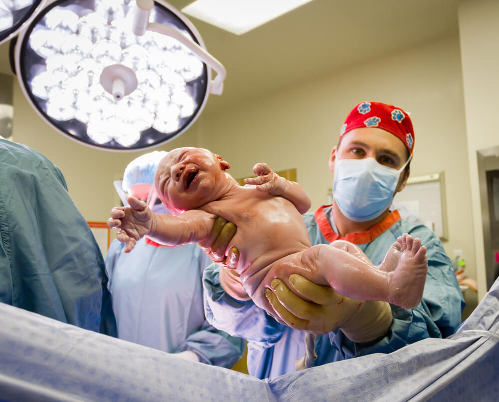 Everything You Dont Know About A C Section