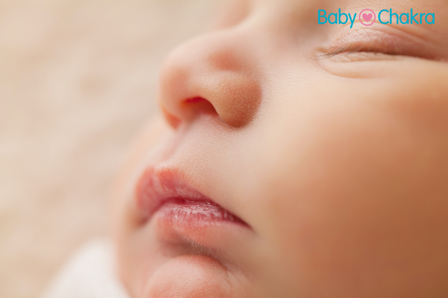 Everything You Need To Know About Newborn Lip Blisters And Their Treatment