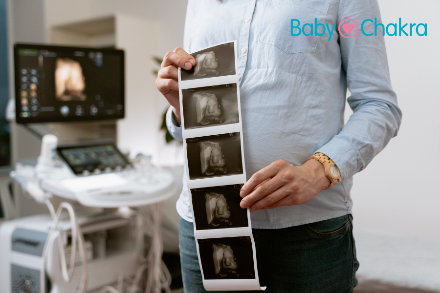 Pregnancy Ultrasound: Types, Procedure, And Preparation
