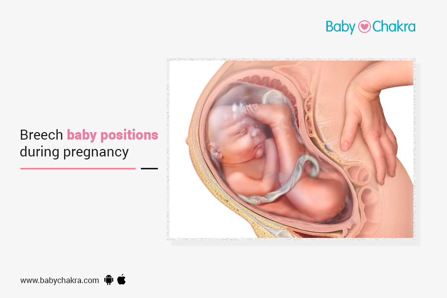 Breech Baby Positions During Pregnancy