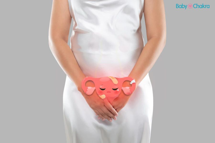 Vaginal Thrush: प्रेगनेंसी में वजायनल थ्रश होने के कारण और बचने के उपाय