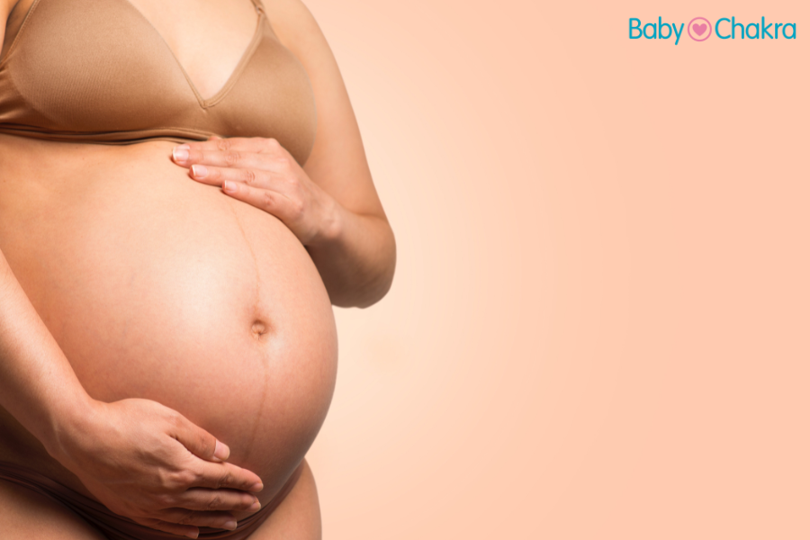 Is Linea Nigra A Sign Of A Healthy Pregnancy Or Just A Common Occurrence?
