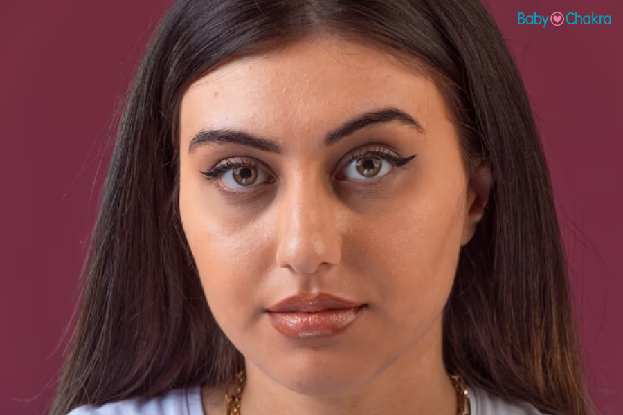 Can Pregnancy Cause Under-Eye Bags? An In-Depth Look At The Connection