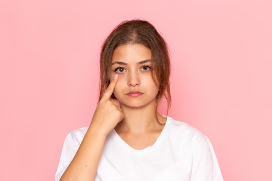 under-eye bags
