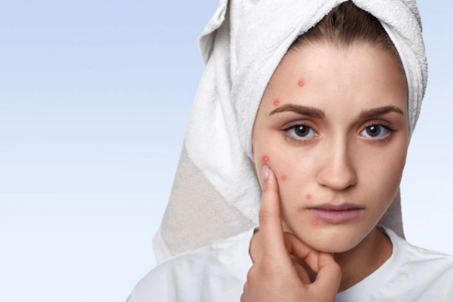 Benefits Of Using Face Scrub