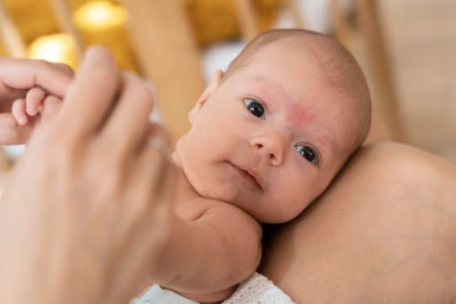Dry Skin In Babies